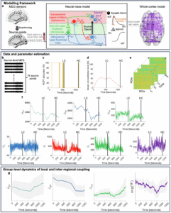 Read more about the article Cortical connectivity, local dynamics and stability correlates of global conscious states